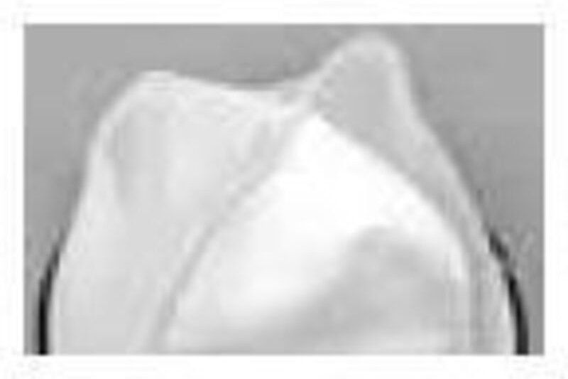 Thumbnail - Ersatzfilter für Lavor Gb/Genio/Eac/Gbx 52120043