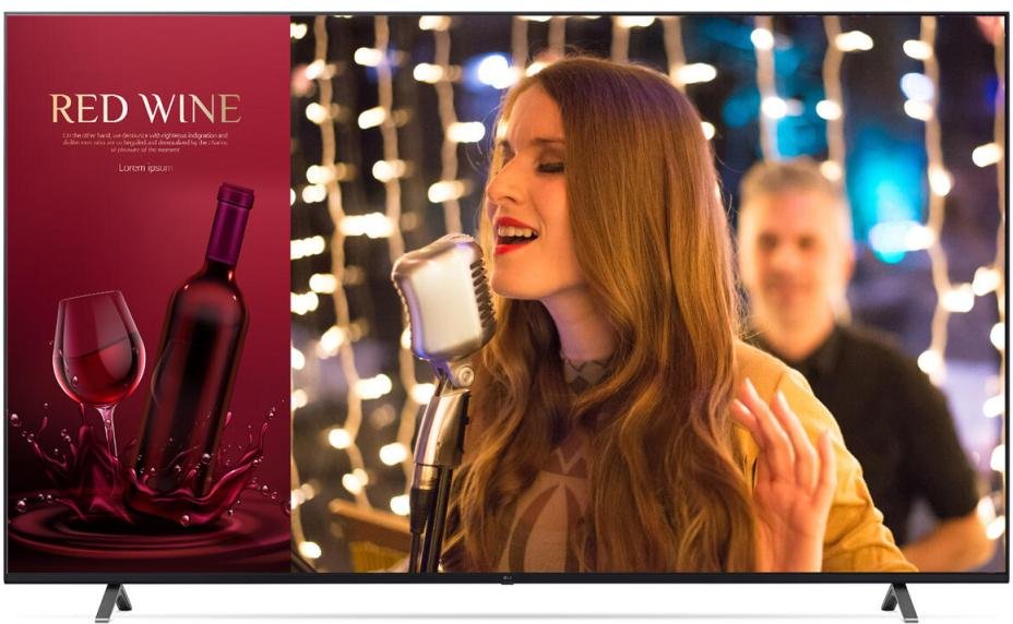 LG 75UN640S 4K Ultra HD Hotel TV 190,5 cm (75")