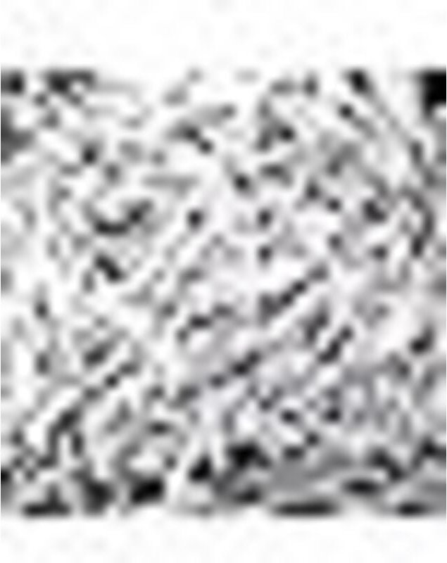 300 Stück Leimtropfer, Leimflaschenspitzen, Leimtropferspitzen, Mikro-Leimspitzen aus Kunststoff, Tropfpipetten mit lang...