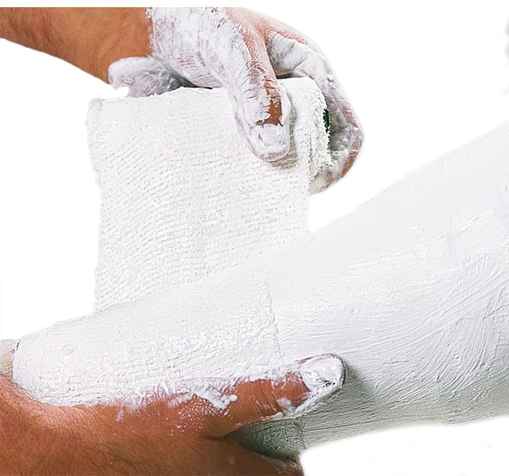 Cellona Gipsbinden 10 cmx2 m St Binden