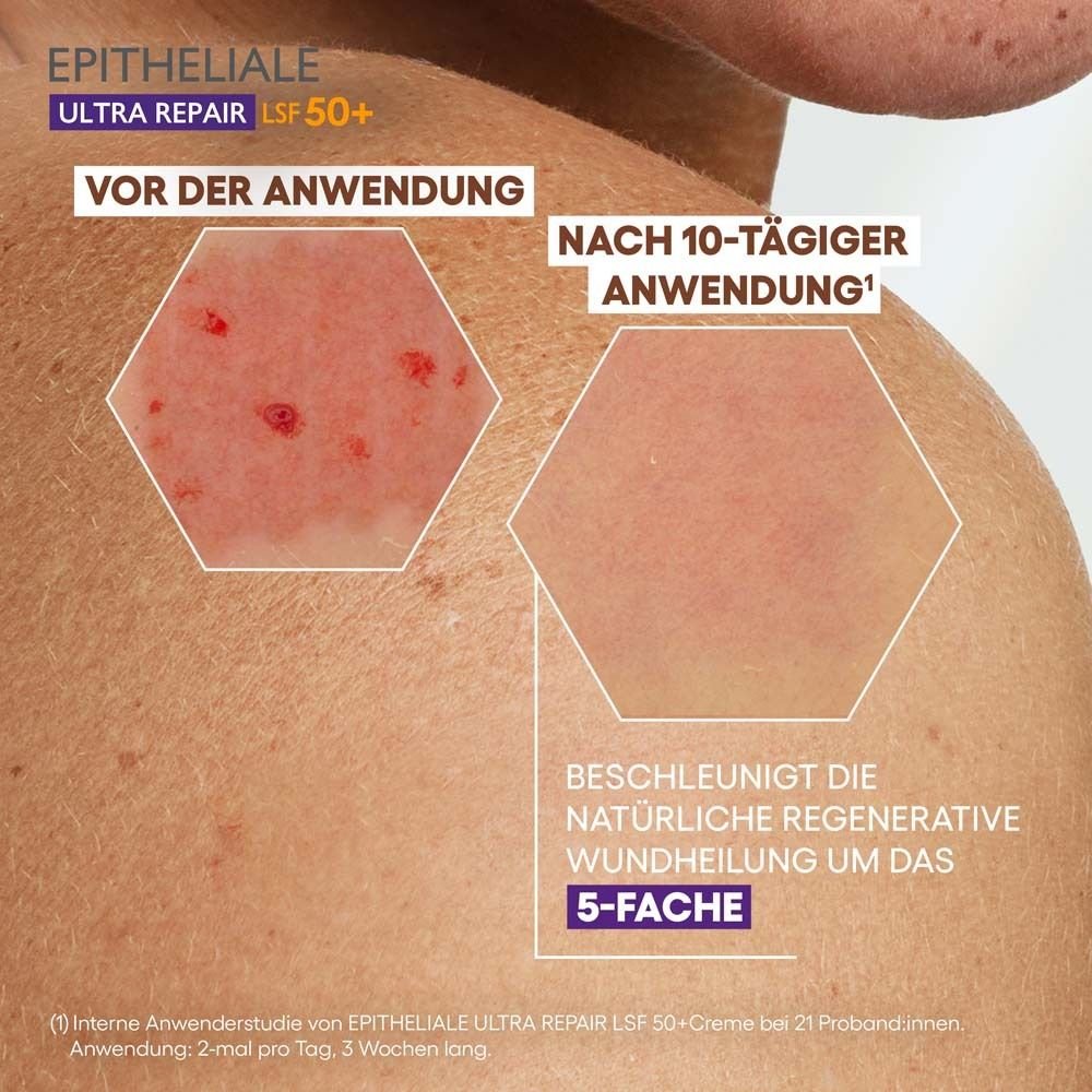 A-Derma Epitheliale Ultra Repair Creme LSF 50+ 40 ml