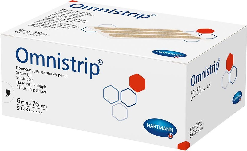 Omnistrip Wundnahtstreifen 6x76 mm 150 St Pflaster