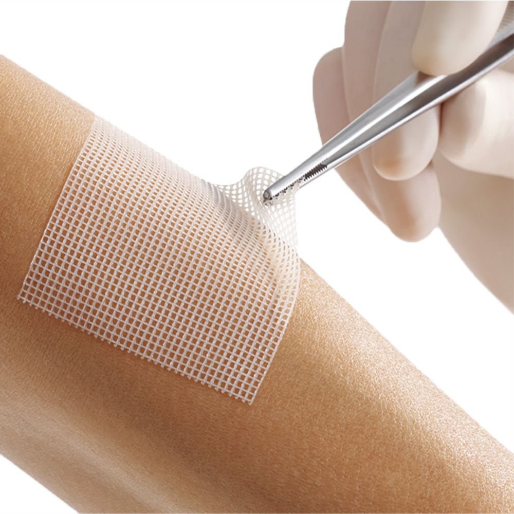 Lomatuell Pro 10x10 cm steril 50 St Wundgaze