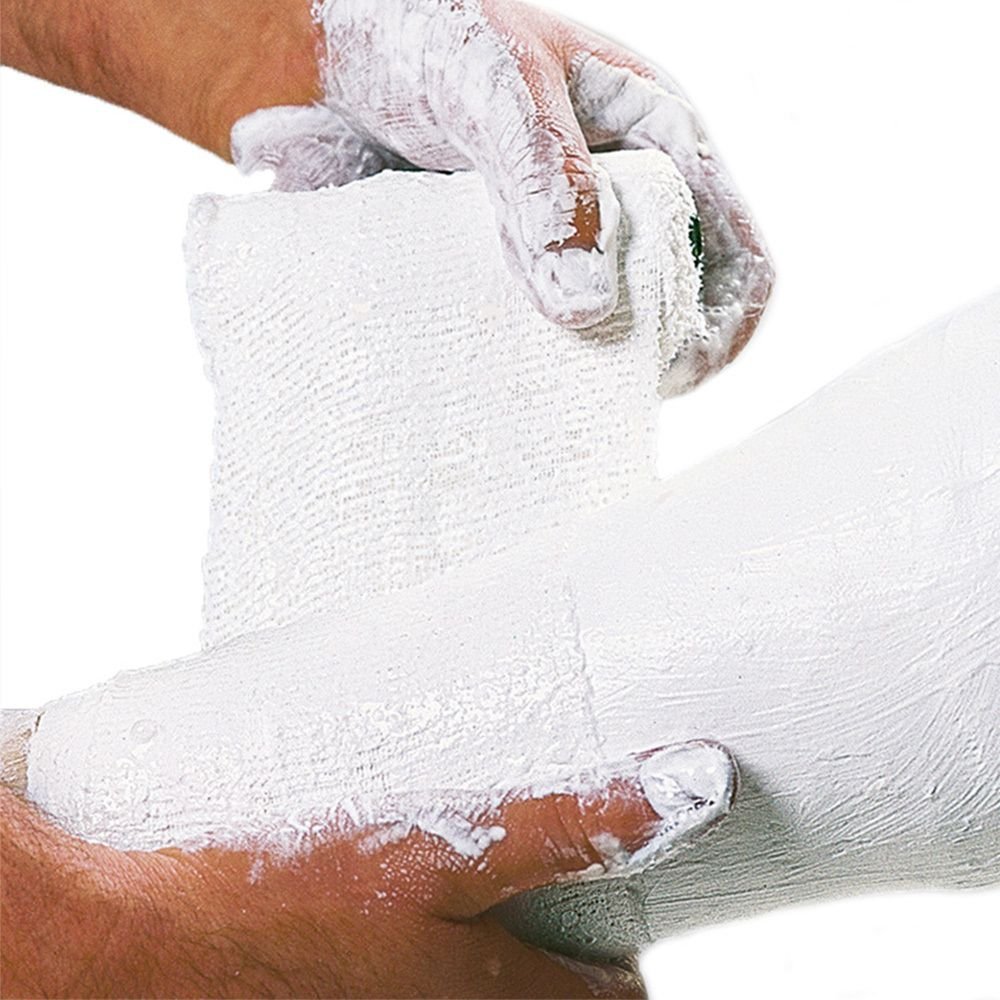 Cellona Gipsbinden 20 cmx2 m 10 St Binden