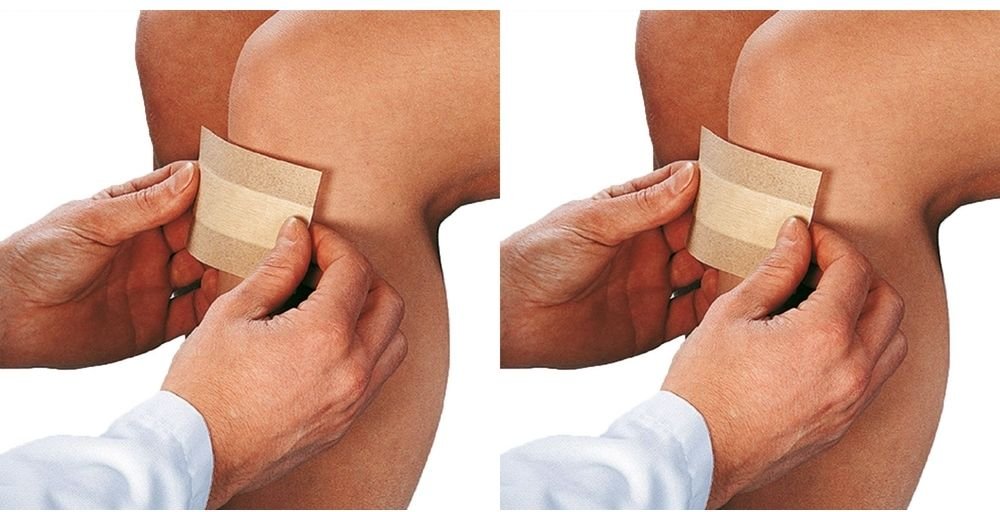 Curaplast Wundschnellverb.sensitiv 8x10 cm 1 m 2x 2x10 St Pflaster