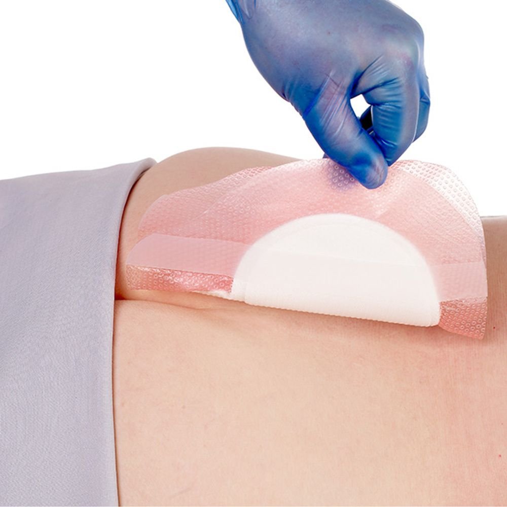 Allevyn Life Sacrum gr.21,6x23cm Silik.Schaumverb. 10 St Verband