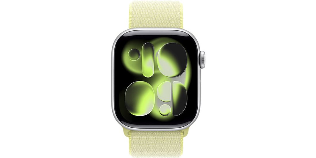 Apple Sport Loop giallo neon (42 mm)