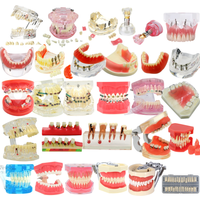 Dental Teeth Model Dental Teaching Model Standard Implants Models Orthodontic Model Dentistry Dentist Demo Studying