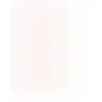 AliExpress EOENKK aperture 21.2MM 21700 lithium battery bracket 13 series bracket DIY electric bicycle lithium battery pack fixing bracket