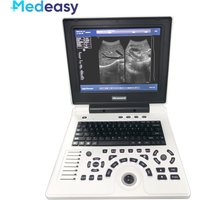 12 Inch Portable Notebook B Ultrasound Scanner Echo Machine Full Digital Diagnostic Device