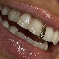 RACHELZ Hip Hop Single Glossy Vertical Bar Teeth Grillz Simple 14K Gold Plated Long Stick Tooth Caps For Women Men Jewelry