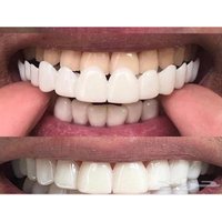 Top Selling Smile Dental Upper False Fake Teeth Cover Perfect Smile Veneers Comfort Fit Flex Whitening Denture CK848-FRO