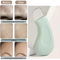 New 1Pc Blackhead & Whitehead Removal Tool For Nose and Face Convenient Undamaged Skin Pore Cleaner Women Skin Care Tools