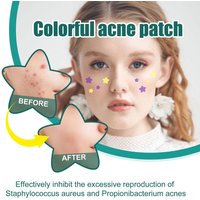 280/1120/1680pcs Star-Shaped Acne Care Patches Hydrocolloid Spot Stickers Absorbing Pimple Patches for Blemishes