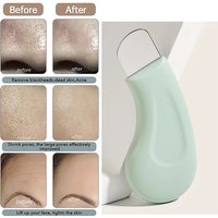 Deep Cleansing Beauty Tool Professional Blackhead Whitehead Remover Effective Pore Cleaner for Nose and Face Practical Skin Care