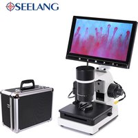 HD-Digitalmikroskop für die Blutmikrozirkulation, professionelles Nagelfalz-Kapillarmikrozirkulationsmessgerät + 7'- oder 9'-Farb-LCD-Display OSL