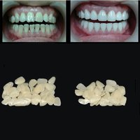 70PCS/Package Dental Ultra-Thin Whitening Veneers Resin Teeth Upper Anterior Hot