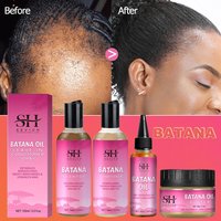 Batana Haarwachstumsöl, Anti-Haarausfall-Set, Traktion, Alopezie-Behandlung, Shampoo, nährendes Anti-Haarausfall-Conditioner, Haarpflege