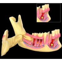 Mandibular Decomposing Model Lower Gingival Side Can Open Demonstration Anatomical Model Teaching Model