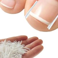 50Pcs Ingrown Toe Nail Treatment Elastic Patch Sticker Straightening Clip Ingrown Toenail Correction Tool Brace Pedicure Tool