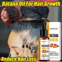 Batana-Öl, Haarwachstumsprodukte, schnelles Wachstum, Batana-Essenzöl, Traktion, Alopezie, Anti-Haarausfall, Kahlheitsbehandlung für Männer und Frauen