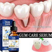 Damaged Gum Repair Care Toothpaste Relieve Sore Gums Allergy Deep Cleaning Teeth Stains Tartar Serum Dental Caries Toothpaste