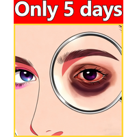 Deep eyes. Deep moisturizingᑫᵘⁱᶜᵏˡʸ ʳᵉᵐᵒᵛᵉˢ ᵉʸᵉ ᵇᵃᵍˢ ᵃⁿᵈ ᵖʳᵒᵗᵉᶜᵗˢ ᵗʰᵉ ᵉʸᵉ ᵃʳᵉᵃ