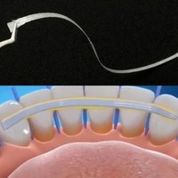 1/2/5Pcs Dental Material Flexible Fiber Strip Glass Splint Loose Tooth Fixation Strips Light Cure Bonding Orthodontic Retainers