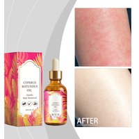 60ml Cyperus Rotundus Oil Natural Hair Growth Inhibitor Smoothing Body Serum After Shaving Waxing Care Liquid