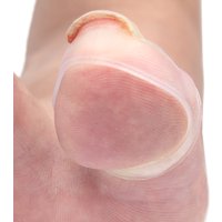 Hot Sale 1Pair /2Pcs High Quality Silicone Ingrown Toenail Correction Tool Invisible Ingrown Toe Nail Treatment