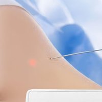 Lipolysis Endolaser 980nm 1470nm Optical Fiber Therapy Liposuction Vaser Cannula Skin Tightening Diodo Facelifting CE ROHS