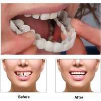 FreshVeneer Snap-on Teeth Kit Fake Temporary Tooth Whitening Replacement Men Women CK848-FRO