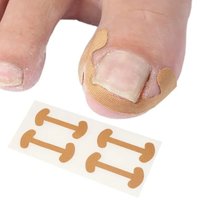 1-12 sheet Professional Ingrown Toenail Foot Corrector Stickers Elasticity Toe Nail Care Pedicure Tools Health Care Toe Nail