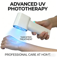 Handheld Vitiligo Lamp Home Use 308nm UVB Lamp for Vitiligo Phototherapy Light Therapy for Psoriasis Spots Eczema Skin Disease image 4