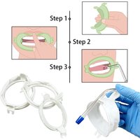 Professional Grade Disposable Mouth Retractor for Dental Surgery and Cleaning Procedures