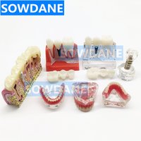 Dental Study Teaching Model Dental Impant Standard Model Removable Teeth ADULT Child TYPODONT Model Dentist Communication Model