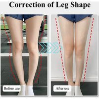 1Pair O/X Leg Type Valgus Correction Gel Insole Plantar Fasciitis Silicone Orthopedic Insoles for Feet Magnet Massage Shoe Pads