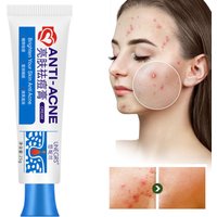 Herbal Acne Removal Face Cream Clears Pimple Scar Black Dots Gel Acne Treatment Shrink Pore Skin Whitening Lightening Ointment