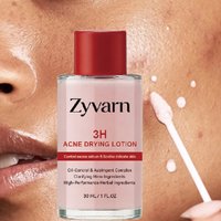 30ml Pink Salicylic Acid Concentrated Acne Essence - Containing Salicylic Acid, Lactose Acid, Calamine, Double Acid Dual Care