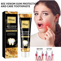 Bee Venom Gum Care Toothpaste Effectively Removes Yellow Teeth and Plaque Long-lasting Fresh Breath Gentle Oral Care Toothpaste