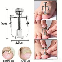 Ingrown Toenail Corrector Straightening Clip Pedicure Foot Nail Care Tools Stainless Steel Pedicure Treatment Correction