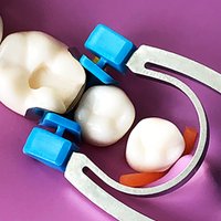 Dental Sectional Matrix System Set G2 30pcs Bands & 1 Handheld retainer Clamp Ring R4 Clip Quick Class Ⅱ Restoration Dentistry