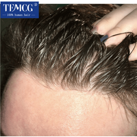 Prothèse capillaire masculine avec ligne de cheveux invisible et peau ultra-fine de 0,03 mm, toupet pour hommes, perruque en cheveux humains, système de remplacement capillaire masculin
