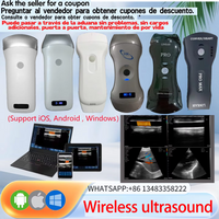 Sonostar Brand Factory Portable Wireless Ultrasound Probe Scanner Portable Machine WIFI Ultrasound Scanner Machine Support OEM