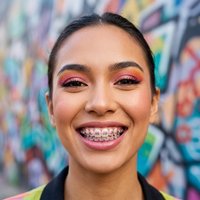 Stylish 1 Pair Color Metal Wire Tooth Braces Temporary Dental Ornament Orthodontic Bracket Ligature Ties Teeth CK1160