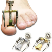 Correction of Paronychia with Toe Nail Correction Bracket for Treatment of Toe and Toe Care with Toe Fixator