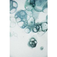 Photocircle Poster / Leinwandbild - Aquarelle Bubbles - Blue