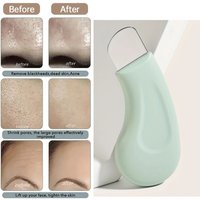 Black head and White head Removal Tool for Nose and Face, Pore Cleaner Skin Care Tools for Women