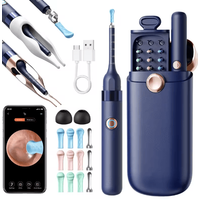 Upgraded Smart Visual Ear Wax Cleaner with 800W HD Camera and Storage Case