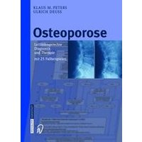 Osteoporose Osteoporose